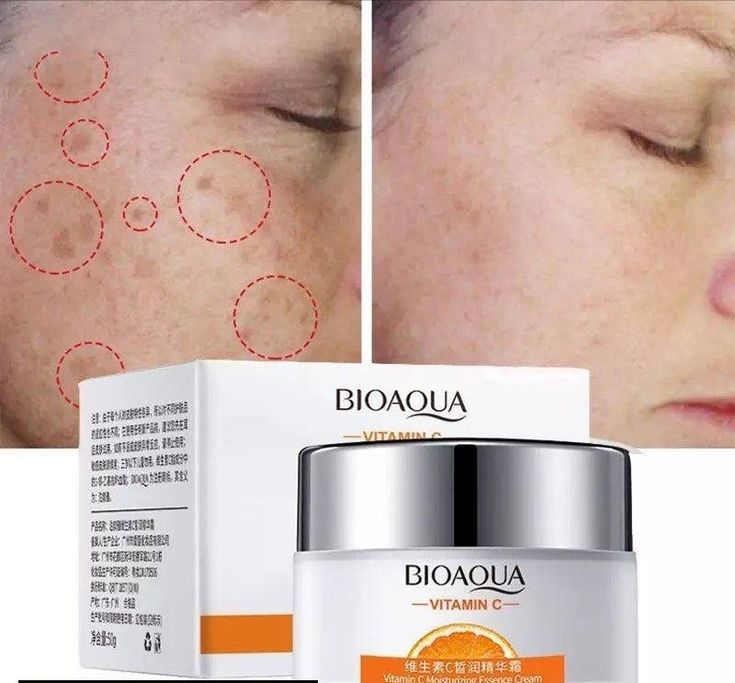 KIT VITAMINA C BIOAQUA